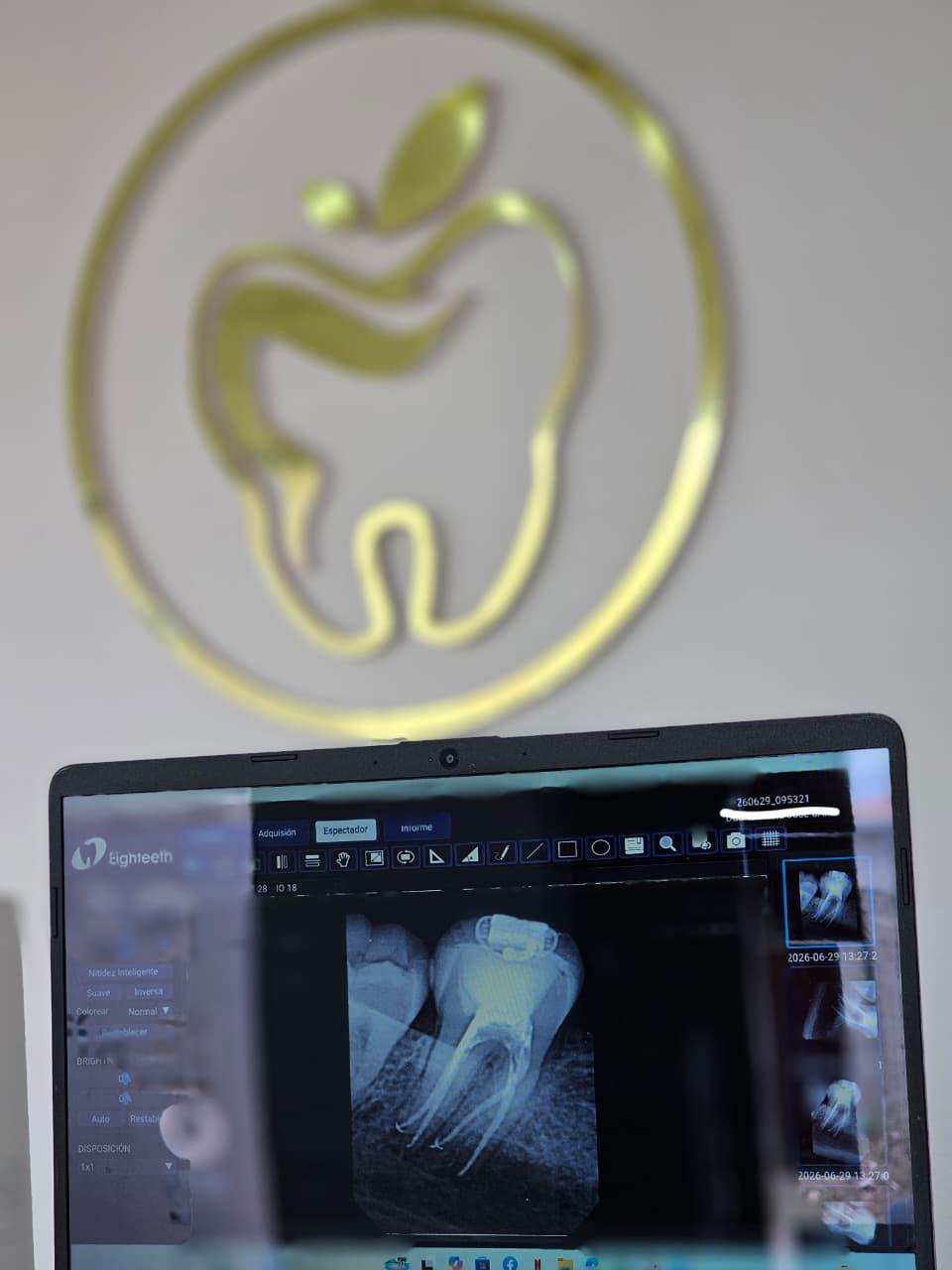 Endodoncia