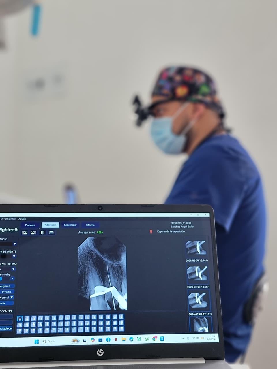 Endodoncia